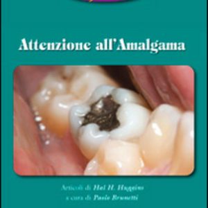 Attenzione all'Amalgama